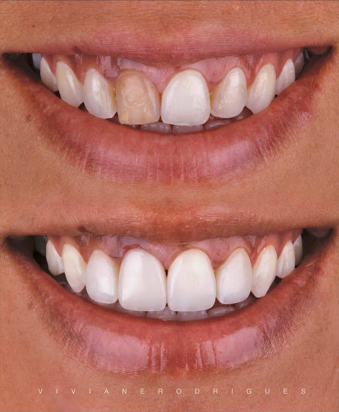 Foto 3 de Dra. Viviane Rodrigues - Odontologia Estética & Reabilitação Oral