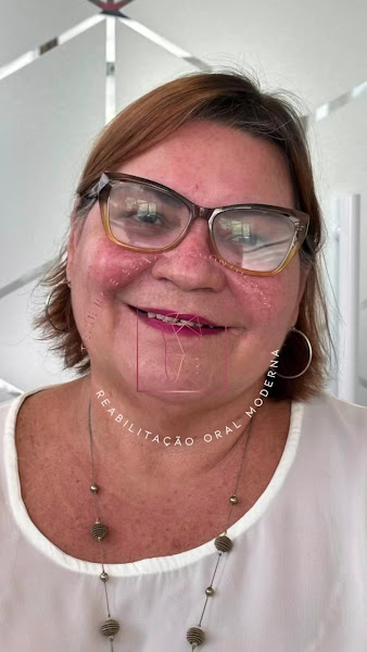 Foto 3 de Dra. Viviane Teixeira | Implantes e Próteses