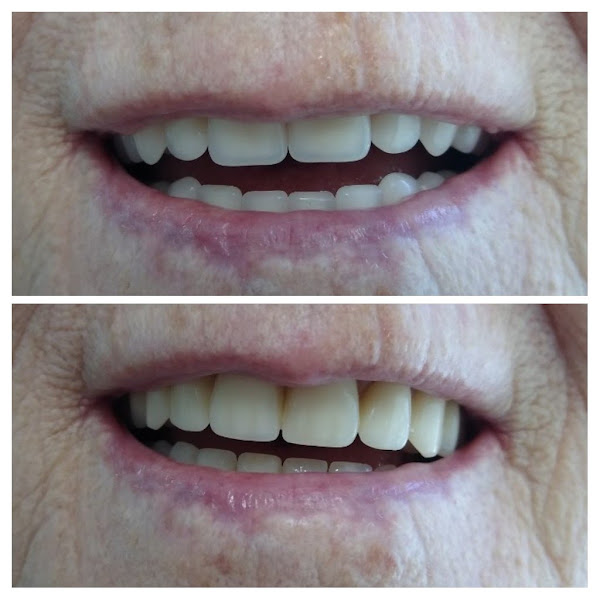 Foto 3 de Dra. Vivianne Aquino Dentista