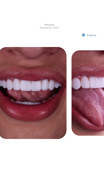 Foto 4 de Dra. Vladja Torno | Facetas em Resina Composta em Curitiba