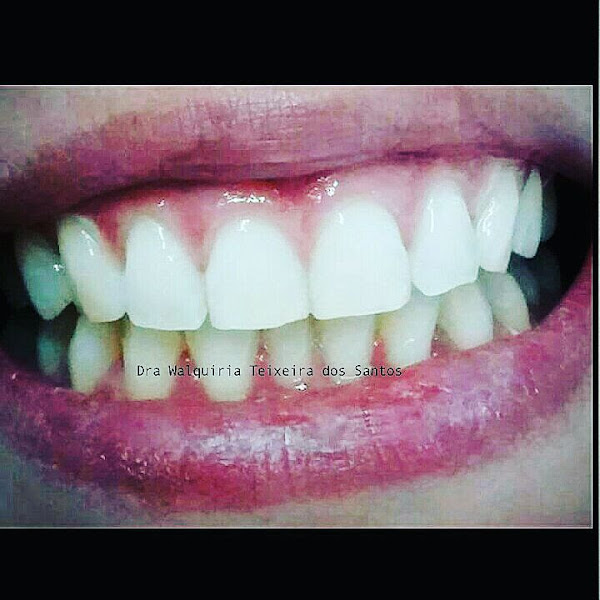 Foto 3 de Dra. Walquiria Teixeira dos Santos