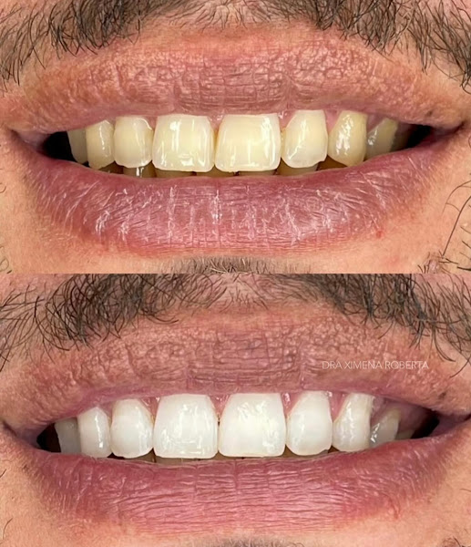 Foto 3 de Dra. Ximena Roberta | Urgência Odontológica e Estética em Recife