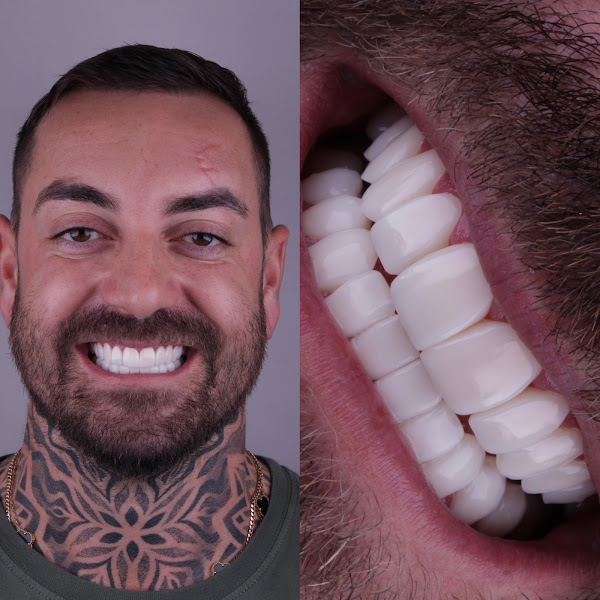 Foto 2 de Dra Yanca Souza - Implantes dentários | Ortodontia | Lentes de contato | Clínico geral.