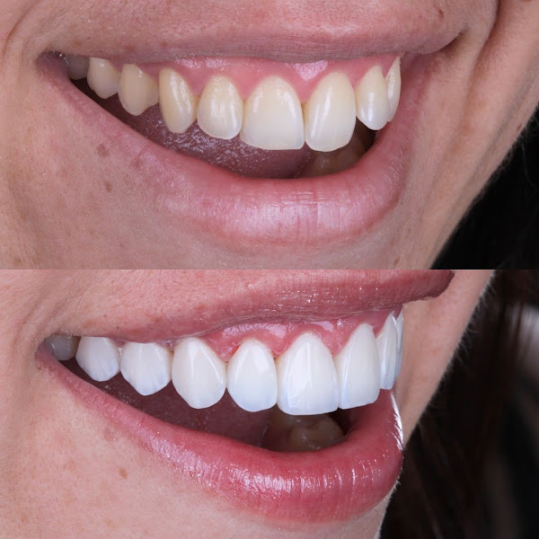 Foto 2 de Dra Yanka Menezes | Dentista em Patos