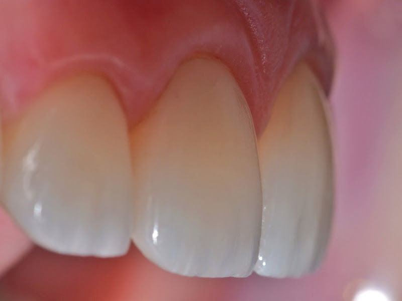 Foto 8 de Dra Yanne Marinho - Dentista em Campina Grande