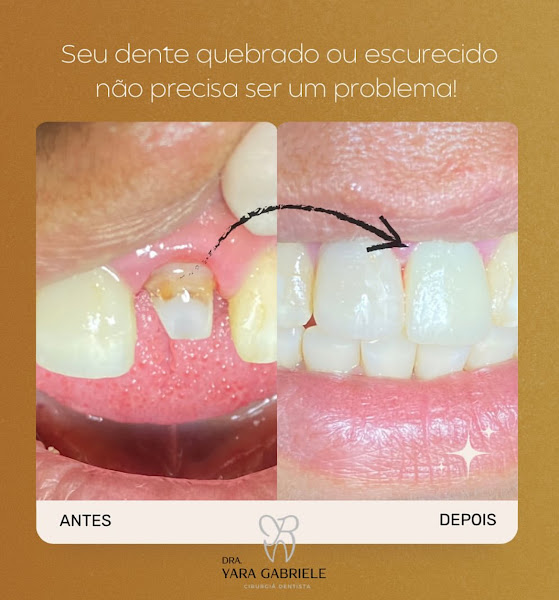 Foto 2 de Dra. Yara Gabriele | Dentista| Prótese e Dentística