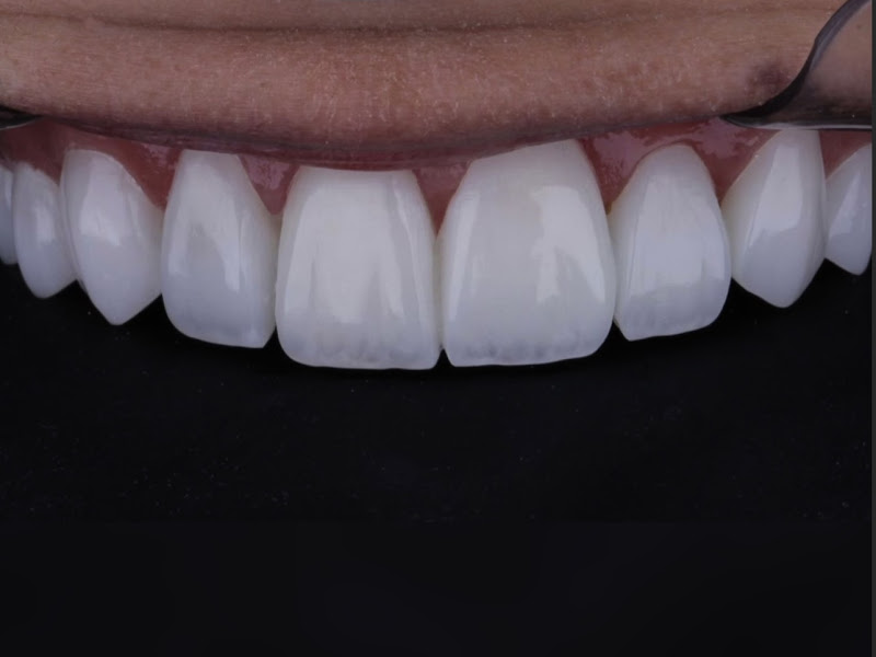 Foto 7 de Dra Yara Lorenzetti Odontologia