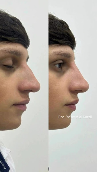 Foto 3 de Dra. Yasmin El Kurdi | Harmonização Orofacial | Cirurgiã dentista |Aparelhos em Guarulhos