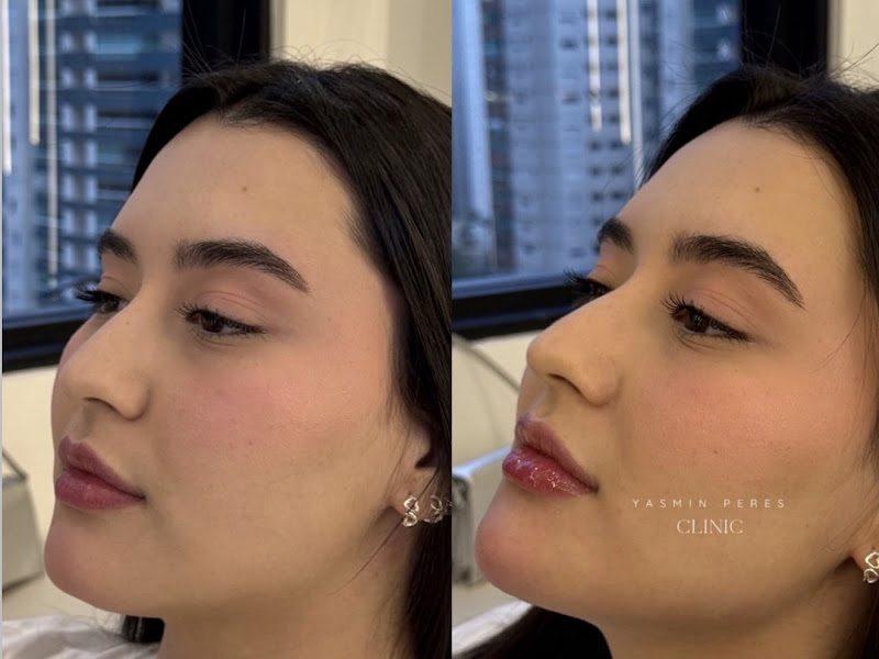 Foto de Dra. Yasmin Peres - Harmonização Facial