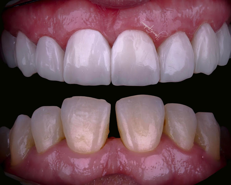 Foto 2 de Dra. Yasmin Spielmann - Dentista Estética – Lentes, Botox e Clareamento | Três Lagoas