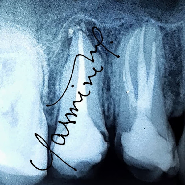 Foto 2 de Dra. Yasmine Marcondes - Endodontista