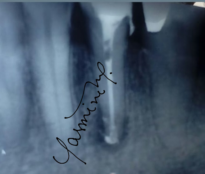 Foto 3 de Dra. Yasmine Marcondes - Endodontista