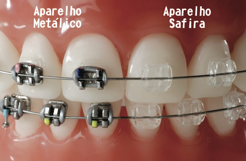 Foto 3 de Dra. Zelnir Vasconcelos