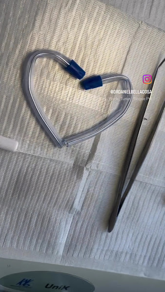 Foto 3 de DRB Odonto | Implantes, Próteses, Ortodontia e Estética no Centro de São Paulo - SP