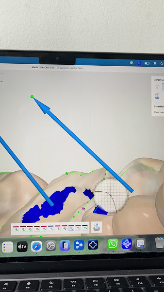 Foto 4 de DRB Odonto | Implantes, Próteses, Ortodontia e Estética no Centro de São Paulo - SP