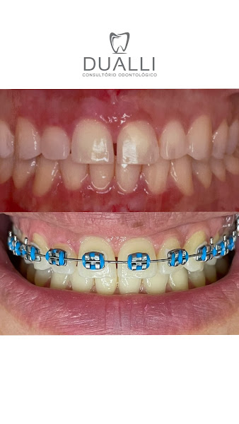 Foto 2 de Dualli Clínica Odontológica |Dentista em Luziânia