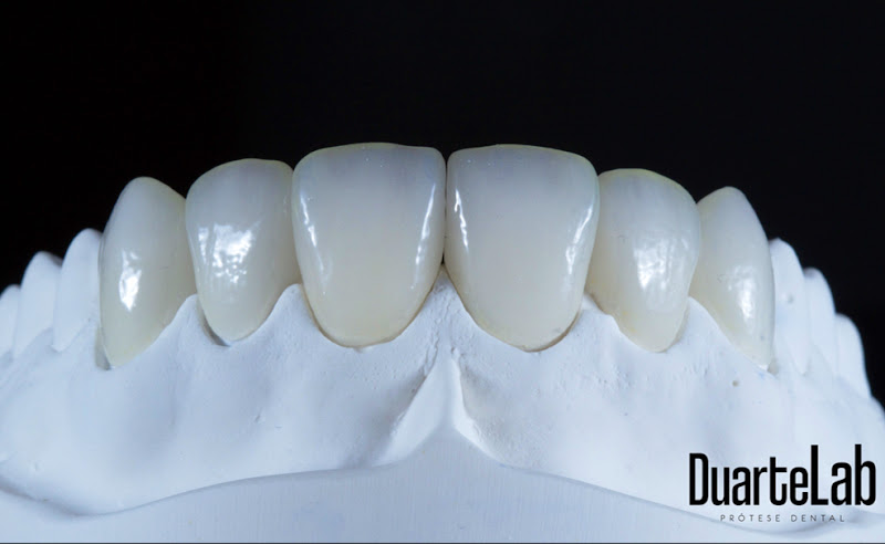 Foto 2 de DuarteLab - Prótese Dental