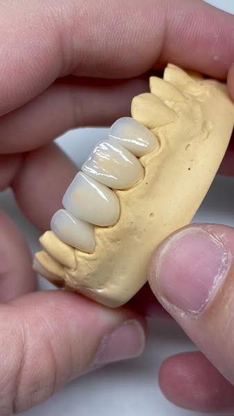 Foto 3 de DuarteLab - Prótese Dental