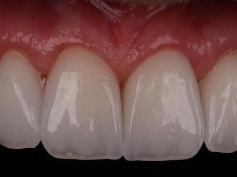 Foto 6 de Duo Ateliê Consultório Odontológico | Dentista