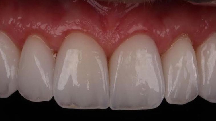 Foto 2 de Duo Studio Oral - Referência em Prótese e Implantes Dentários