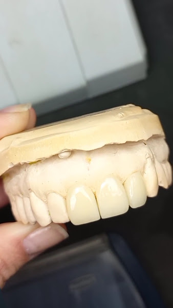 Foto 3 de Duo Studio Oral - Referência em Prótese e Implantes Dentários