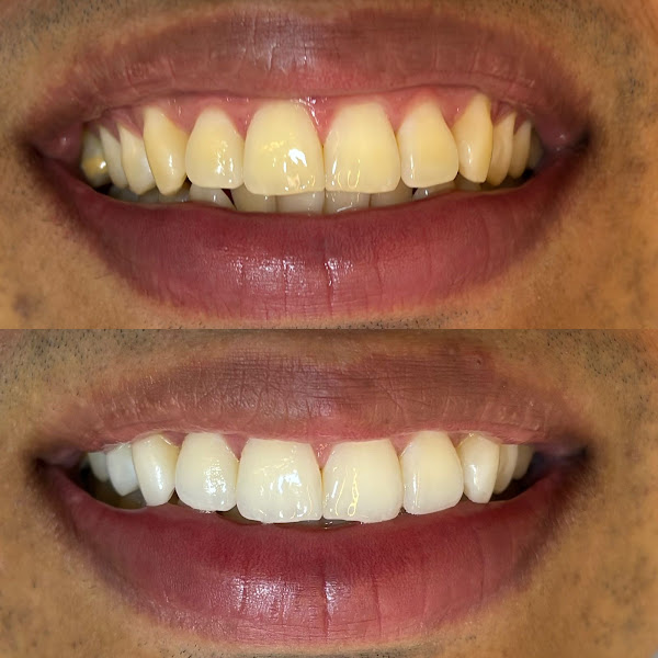 Foto 2 de Duoviso Odontologia - Clínica Odontológica
