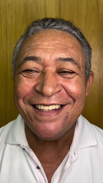 Foto 3 de DV ODONTO - Dentista, implante dentário, prótese protocolo, lentes dentárias, botox, preenchimento, harmonização facial