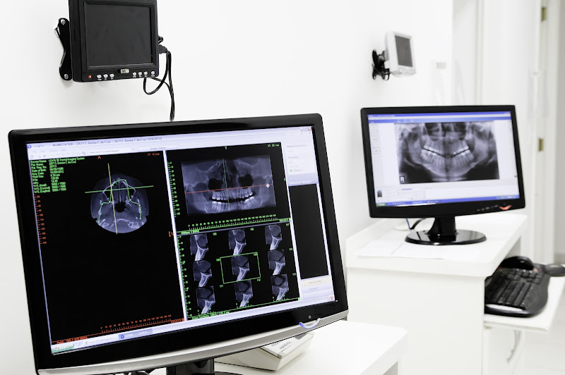 Foto 3 de DVI Diagnóstico Odontológico Ribeirão Preto I: Radiologia, Exames em Ribeirão Preto SP