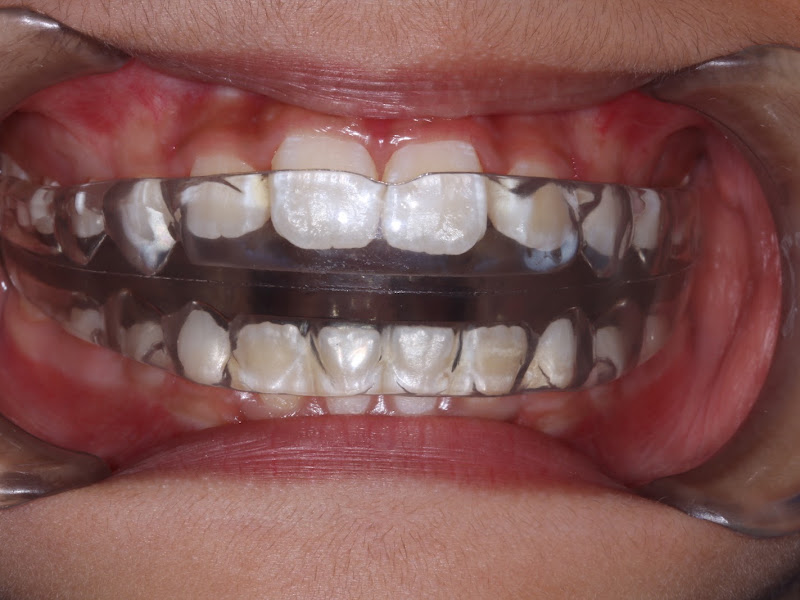 Foto de e.Orto - Odontologia Premium Especializada Instituto Eduardo Dainesi - Pós graduação em Odontologia