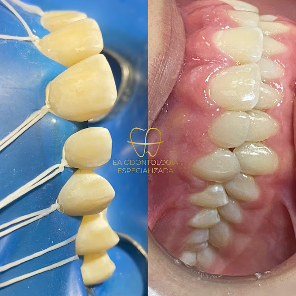 Foto 3 de EA Odontologia Especializada
