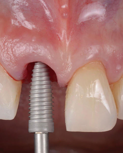 Foto 3 de EasyOdonto