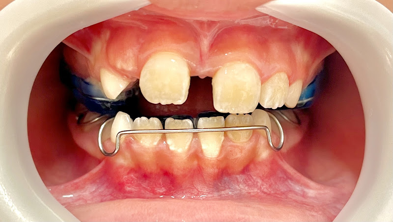 Foto 2 de EB Odontologia Especializada