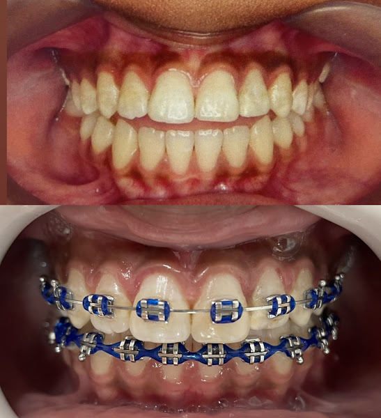 Foto 3 de EB Odontologia Especializada