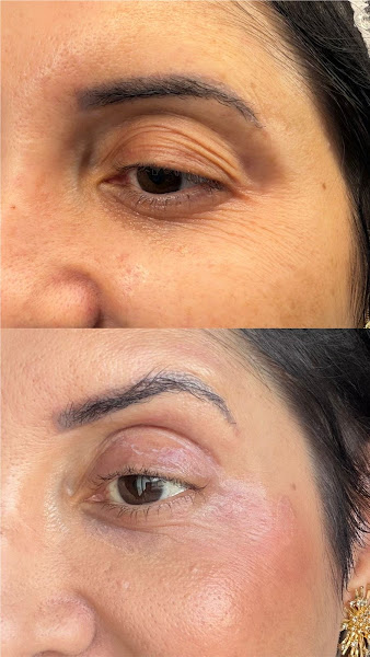 Foto 3 de EccoFace Instituto da Face