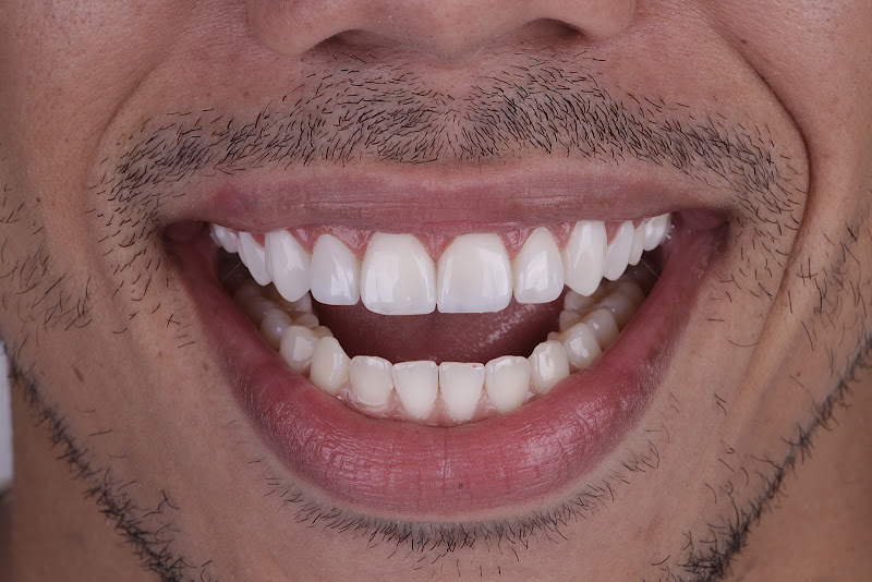 Foto 3 de Edinaldo A. Melo - Odontologia estética