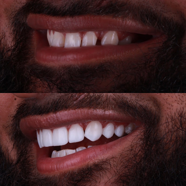 Foto 2 de Edson Dias Odontologia Estética