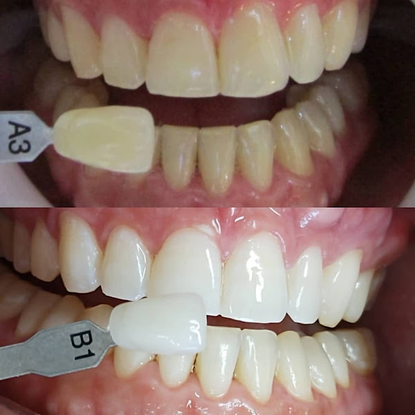 Foto 2 de Edu Gomes Odontologia - Clínico Geral Implantes Lentes Ortodontia Endodontia