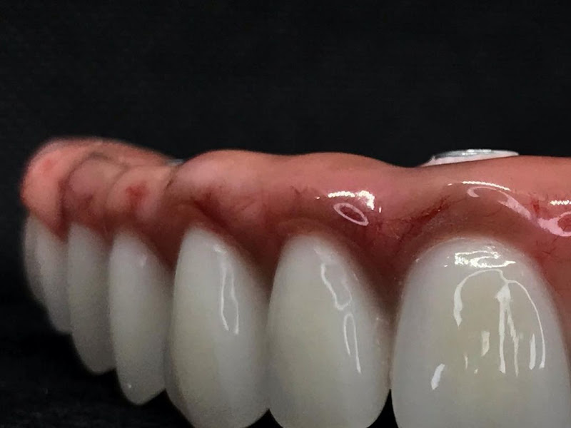 Foto 3 de Elaborart Dental Studio