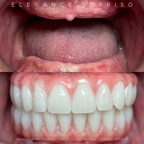 Foto 5 de Elegance Sorriso | Dentista em Campinas