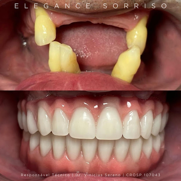 Foto 2 de Elegance Sorriso | Dentista no Campo Grande