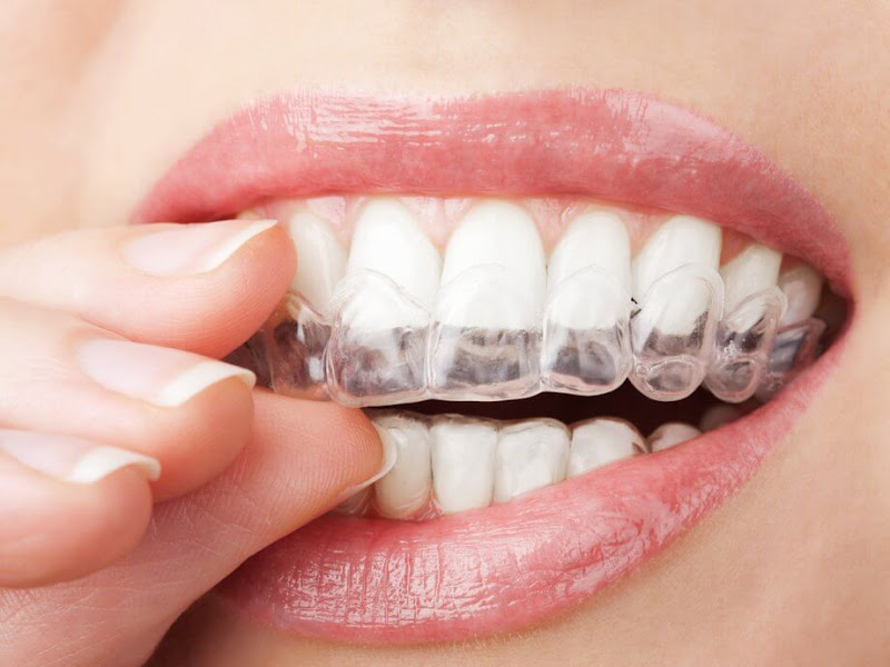 Foto 3 de Elegancy Odonto - Odontologia Estética