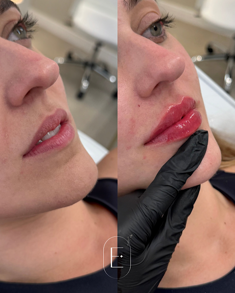 Foto 3 de ELEVARE | Clínica de Estética Avançada