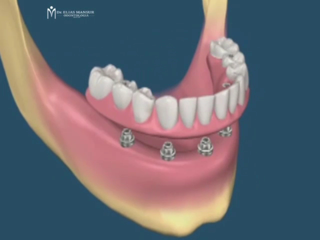 Foto 3 de Elias Mansur Odontologia