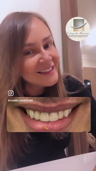 Foto 3 de Elisângela Marcondes • Odontologia Especializada • Cirurgiã Dentista