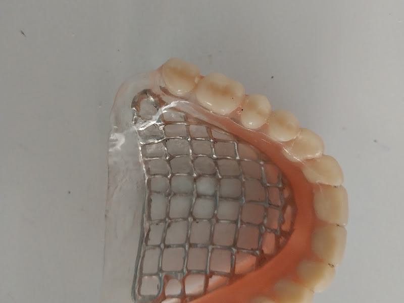 Foto 6 de Elite Protese Odontológica