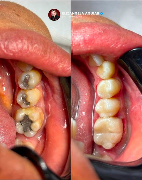 Foto 3 de Eliz Aguiar Odontologia Clínica/Estética e Harmonização Orofacial