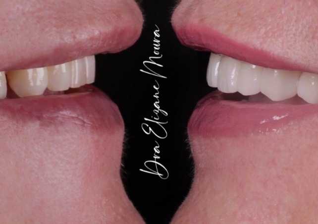 Foto 3 de Elizane Moura Odontologia