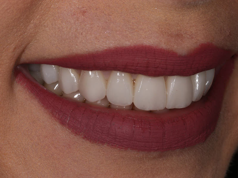 Foto 11 de ELLEVA - Clínica Integrada em Petrópolis - Dentistas / Médicos