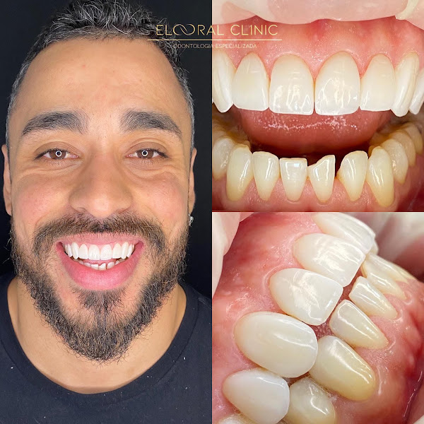 Foto 4 de Elo Oral Clinic