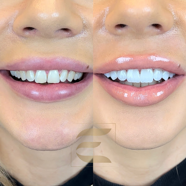 Foto 2 de Elo Oral Clinic - Odontologia